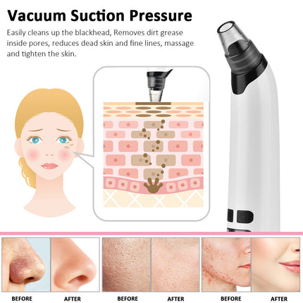 Heating Pore Vacuum Blackhead Cleanser