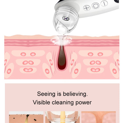 ClearView Pore Refiner